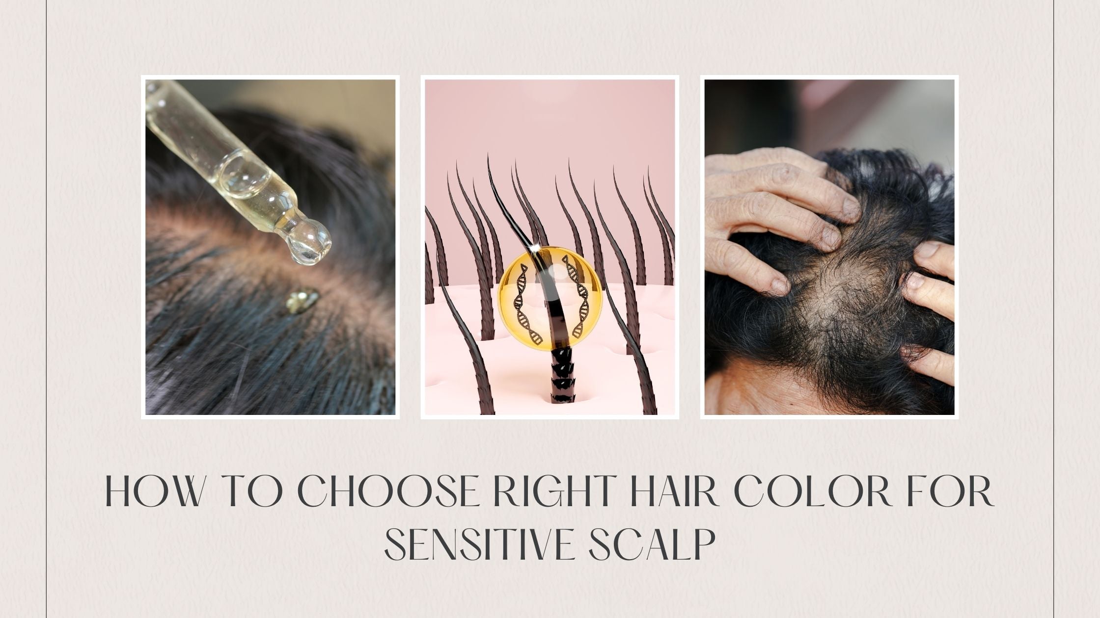 How to Choose the Right Hair Color for a Sensitive Scalp? – Natrique ...